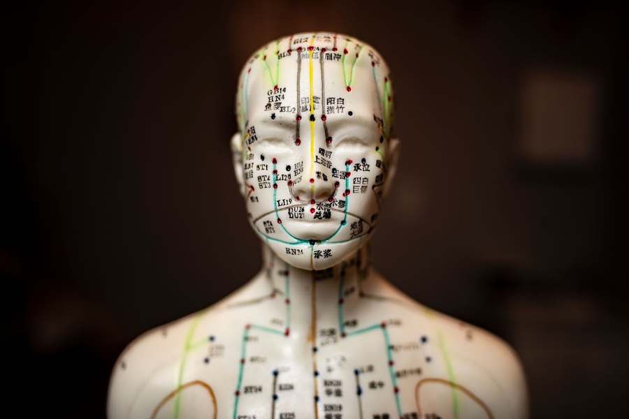 JLV Acupuncture — Acupuncture in Victory Blvd, New York