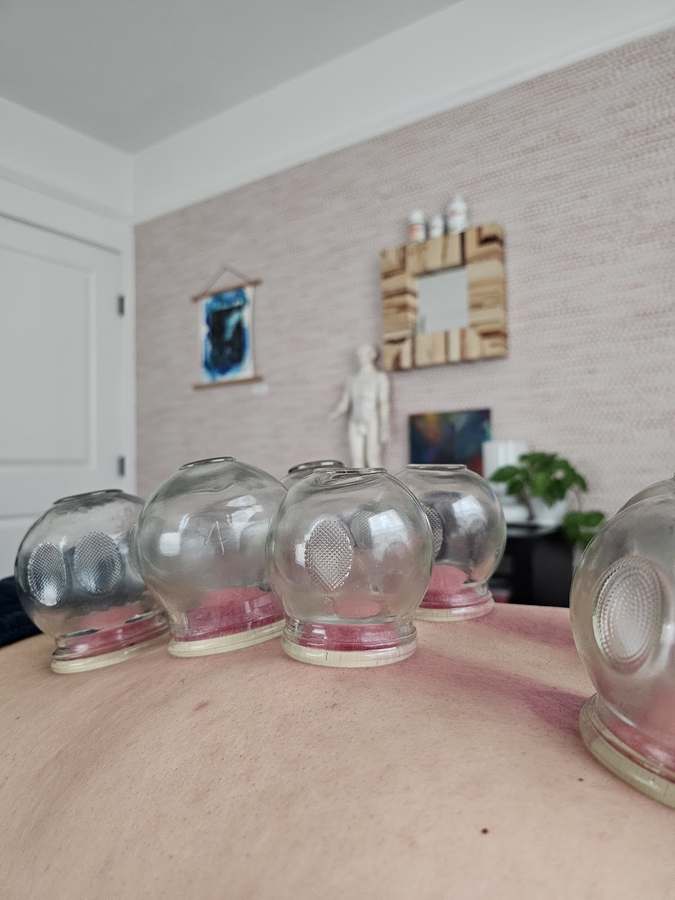 Jeong Chinese Medicine — Acupuncture in Camino del Rio S Ste 104, San Diego