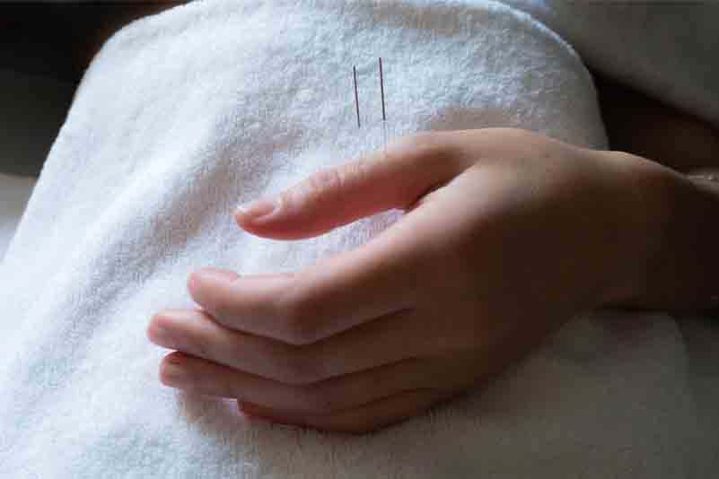 Acupuncture NYC / Medicine of Changes — photo 1
