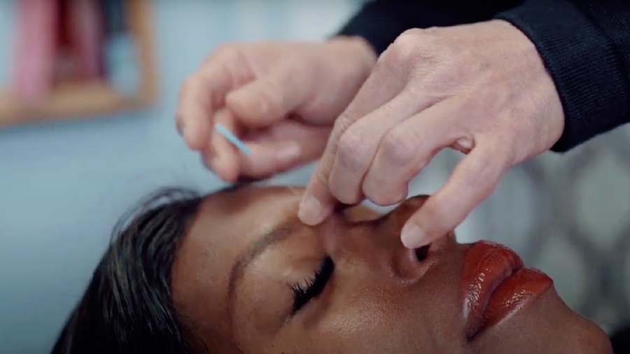 Acupuncture for Balanced Wellness — Acupuncture in W Jackson Blvd #860, Chicago