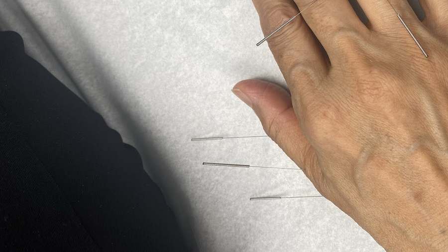 달라스 경희한의원 Dallas Kyung Hee Acupuncture & Oriental Medicine Clinic — Acupuncture in W Main St Ste 204, Dallas