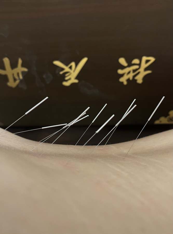 Han Acupuncture Health Center near Encino — Acupuncture in Ventura Blvd Unit 220, Los Angeles