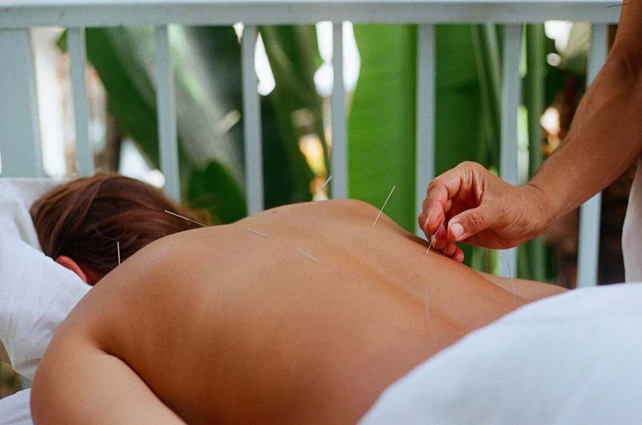 Acupuncture By Mia — Acupuncture in 12th St #12, Miami