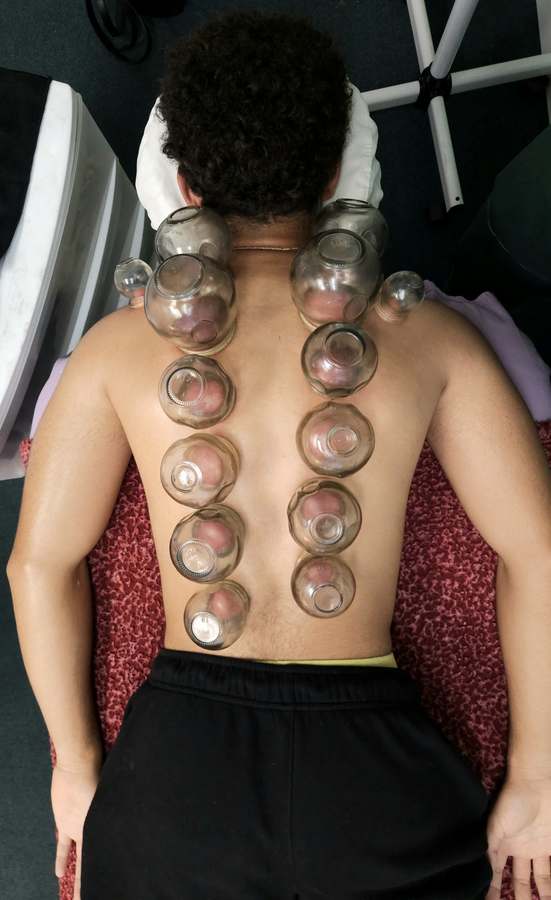 Helping Hands by LC - Massage & Acupuncture- KENDALL — Acupuncture in SW 72nd St, Miami