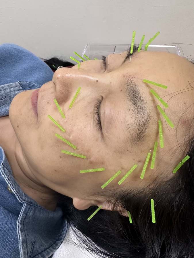 Hialeah Acupuncture Inc. — Acupuncture in W 49th St STE 438, Miami