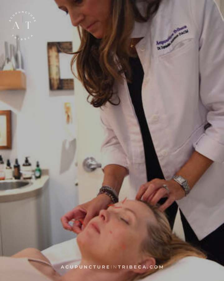 Acupuncture Tribeca — photo 1