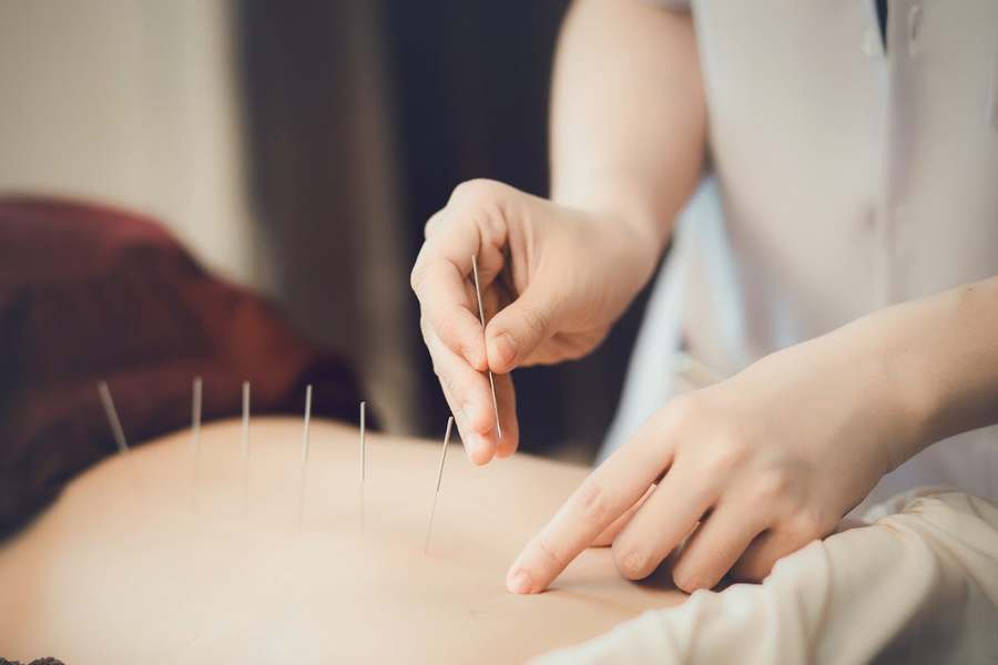 On Acupuncture — Acupuncture in -91 Bell Blvd Ste 205D, New York