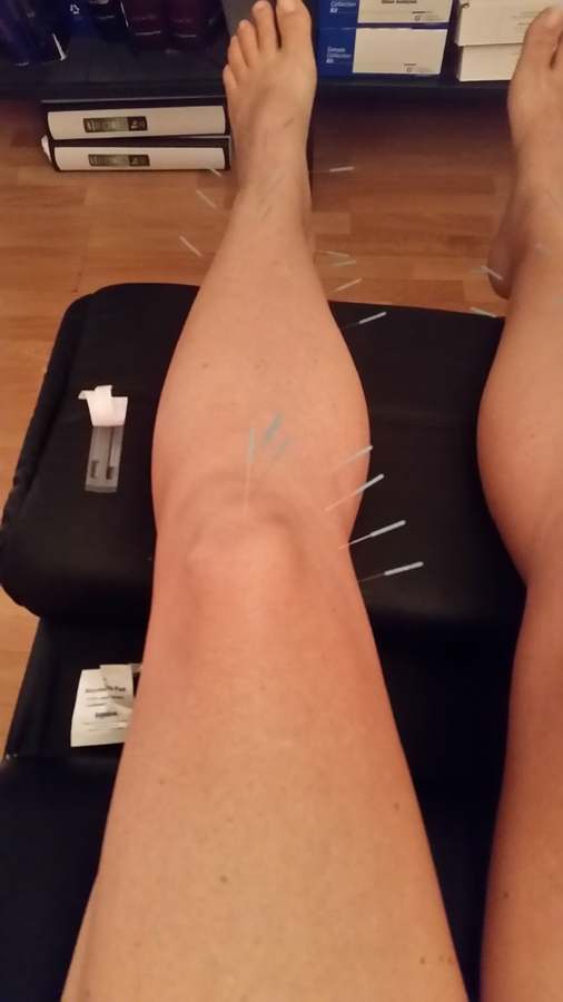 Solutions Acupuncture & Naturopathic Medicine, PLLC — Acupuncture in E Glendale Ave #3, Phoenix
