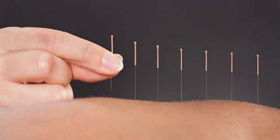 Acupuncture Healthcare Inc. — Acupuncture in World Trade Dr, San Diego