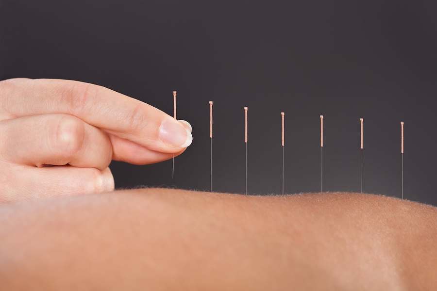 Healthy Star Acupuncture Center — Acupuncture in Bernardo Center Dr #209a, San Diego