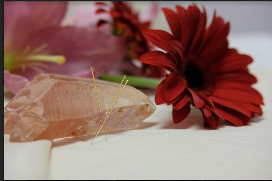 Peaceful Warrior Acupuncture — Acupuncture in Broadway S.T.E.M Achievement Center, San Diego