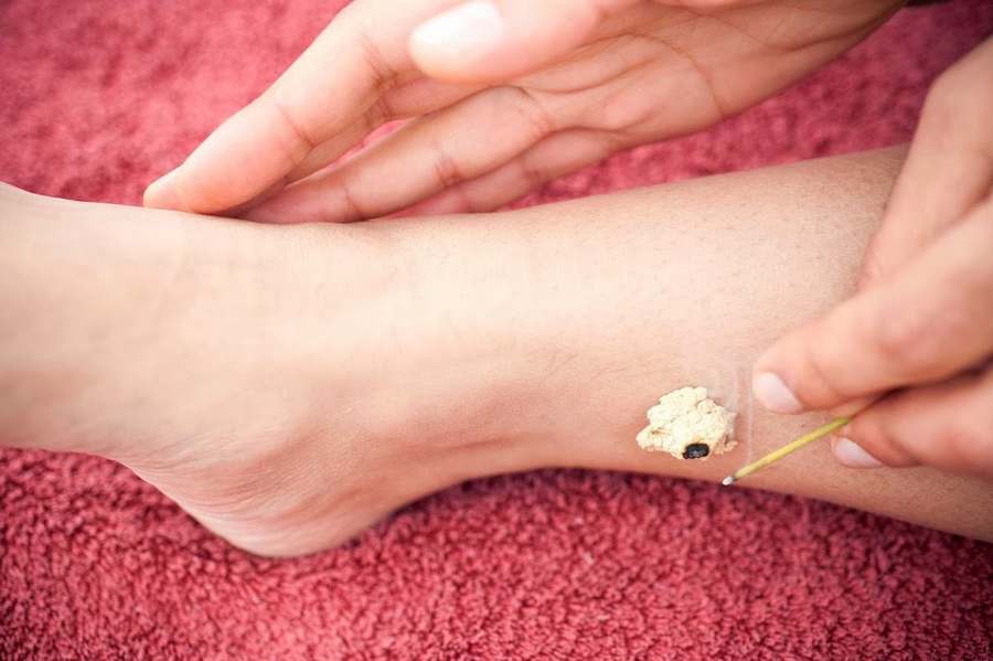Tripat S Chawla, L. EAMP- Sangat Medicine — Acupuncture in 33rd Ave S c4, Seattle